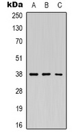 Renin Rabbit Polyclonal Antibody