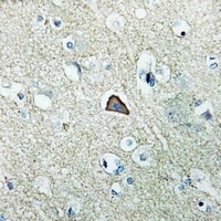 Anti-RhoG Antibody