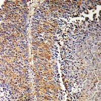 Anti-SH2D2A Antibody