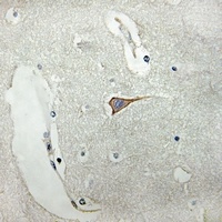 Anti-SCN4B Antibody