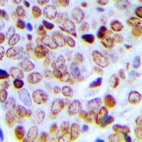 Anti-SFRS15 Antibody
