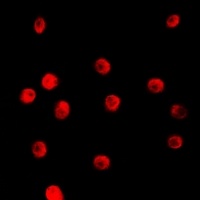 Anti-TCEAL1 Antibody