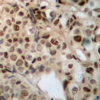 Anti-ZFYVE19 Antibody
