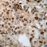 ZFYVE19 antibody