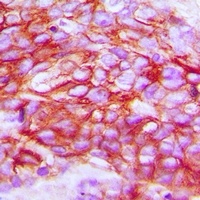 Anti-ZNT1 Antibody