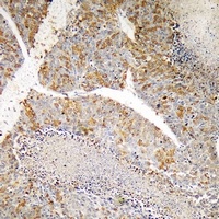 Anti-PI3K p110 gamma Antibody