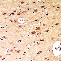 Anti-BNIP3 Antibody