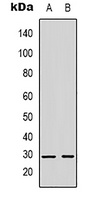 Kallikrein 3 Rabbit Polyclonal Antibody