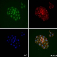 KLK3 antibody