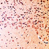 Anti-SHIP2 Antibody