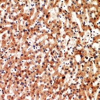 CD3D antibody