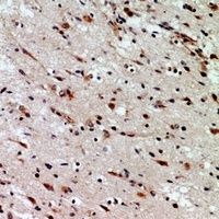 Anti-CD58 Antibody