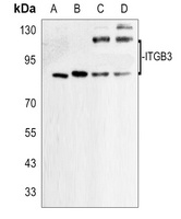CD61 Rabbit Polyclonal Antibody