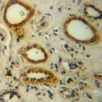 Anti-CD61 Antibody