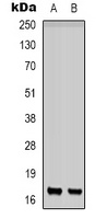 CD225 Antibody
