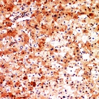Anti-CD276 Antibody