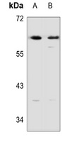DOK1 Antibody