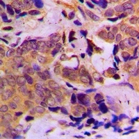Anti-DOK1 Antibody
