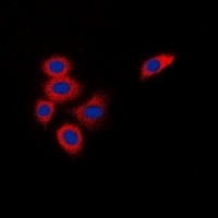 Anti-DOK1 Antibody
