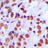 Anti-Histone H2A.X (Phospho-S139) Antibody