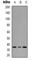 ATF1 (Phospho-S63) Antibody