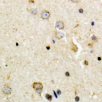 Tyrosine Hydroxylase (Phospho-S8) Rabbit Polyclonal Antibody