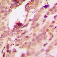 Anti-p38 (Phospho-T180/Y182) Antibody