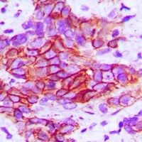 CD104 (Phospho-Y1510) Rabbit Polyclonal Antibody