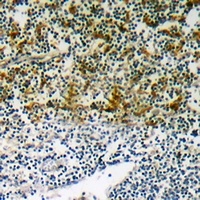 NCF1 (phospho-S345) antibody