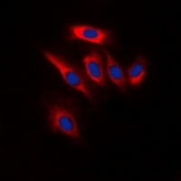 PTEN antibody