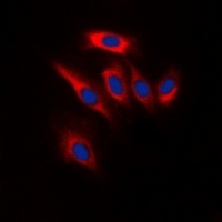 Anti-PTEN Antibody