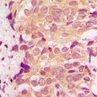 Anti-p38 Antibody