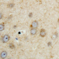 Anti-SPHK2 Antibody
