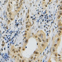 Topoisomerase 2 alpha Rabbit Polyclonal Antibody