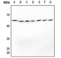 Alpha-tubulin Rabbit Polyclonal Antibody