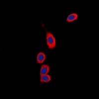 Anti-RPS6KC1 Antibody