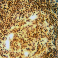 Anti-MMTAG2 Antibody