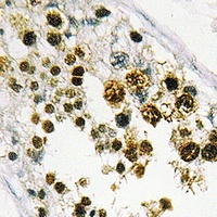 Anti-MRG15 Antibody