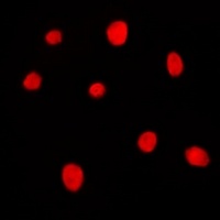 Anti-MRG15 Antibody