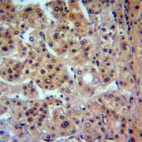 Anti-CADM1 Antibody