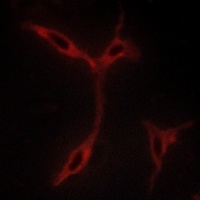 Anti-CADM1 Antibody