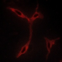 CADM1 antibody