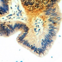 Anti-Apolipoprotein O-Like Antibody