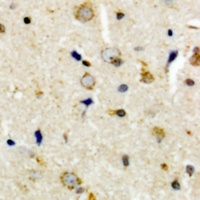Anti-CEP135 Antibody