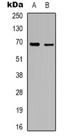 RhoBTB3 Antibody