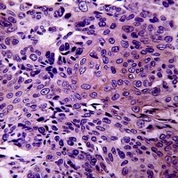 Anti-RhoBTB3 Antibody