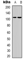 Thrombospondin 4 Rabbit Polyclonal Antibody