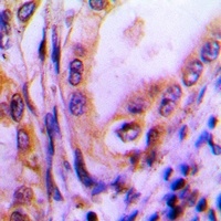 Thrombospondin 4 Rabbit Polyclonal Antibody