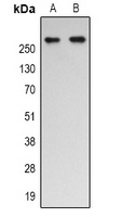 p300 (Acetyl-K1542) Rabbit Polyclonal Antibody