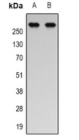 p300 (Acetyl-K1558/K1560) Rabbit Polyclonal Antibody